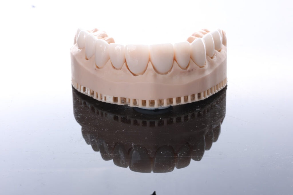 Crowded or overlapping teeth