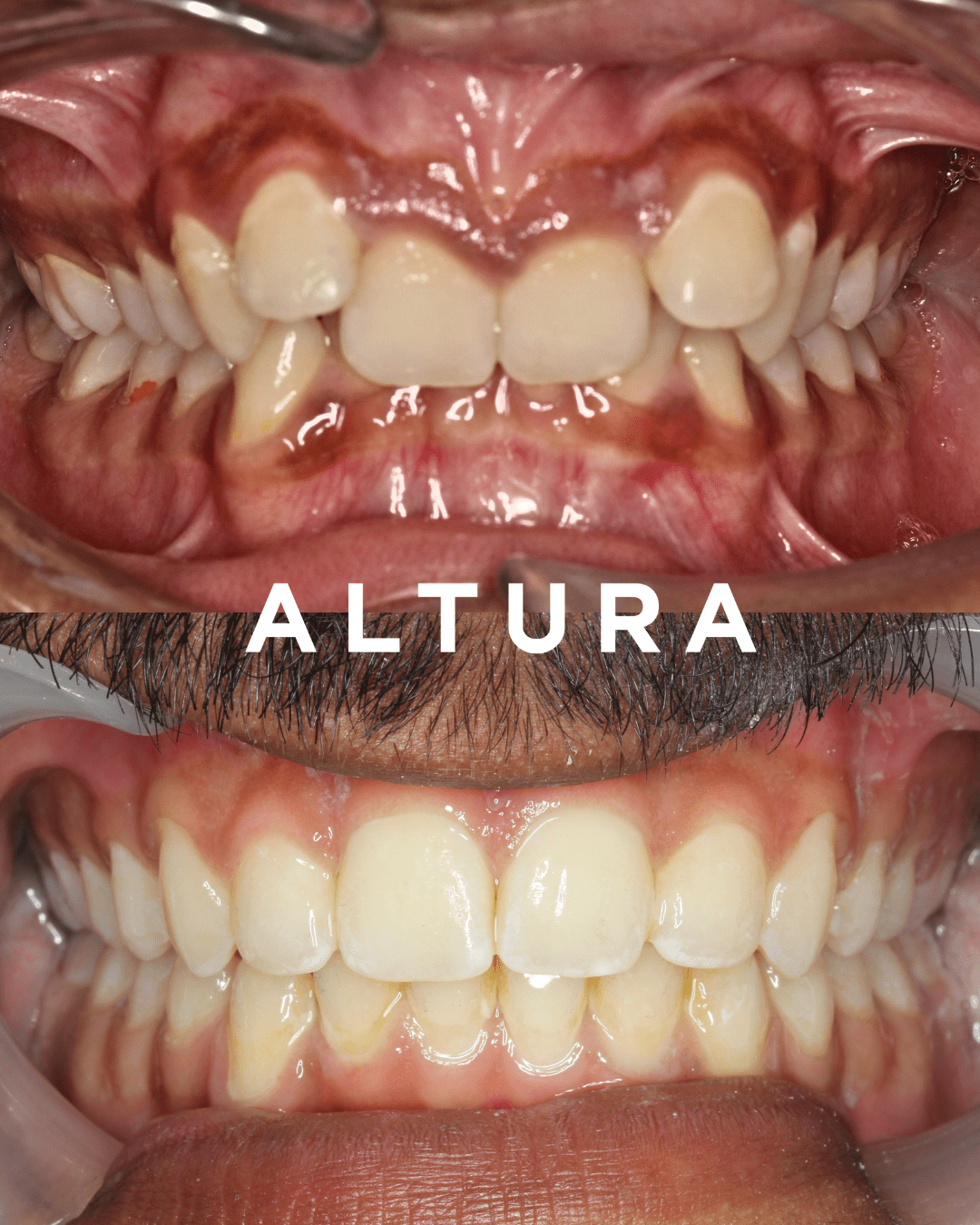 A-OT-TEETH-OB (JMIU)