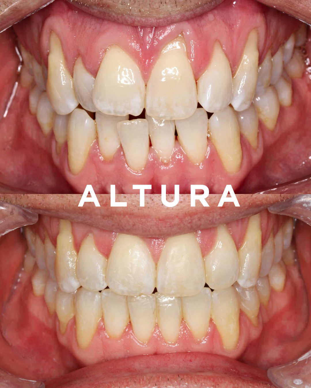 A-OT-TEETH-AL (JMIU)