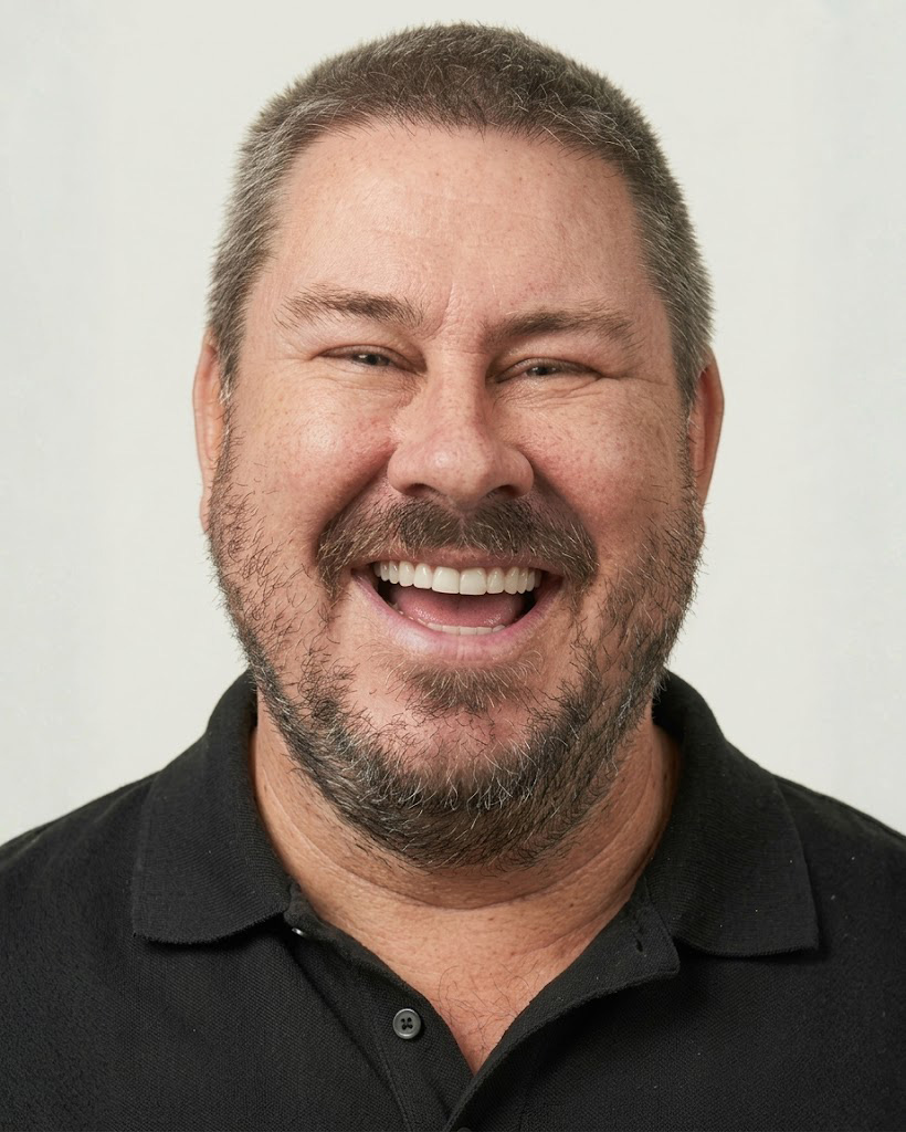 Composite Veneers