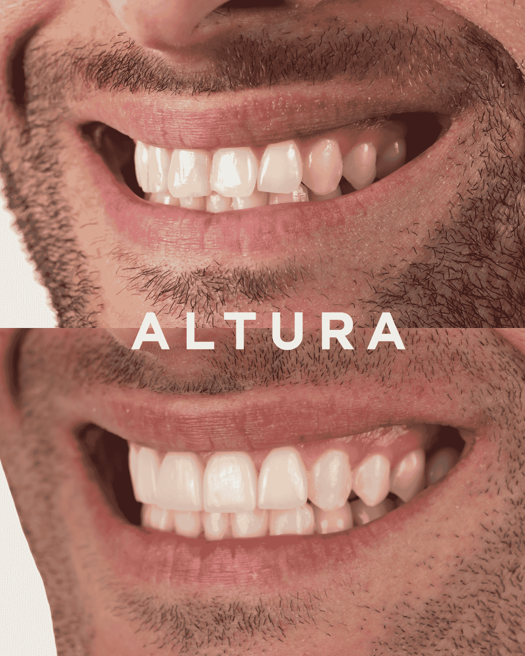C-CR-AC-TEETH-JT2