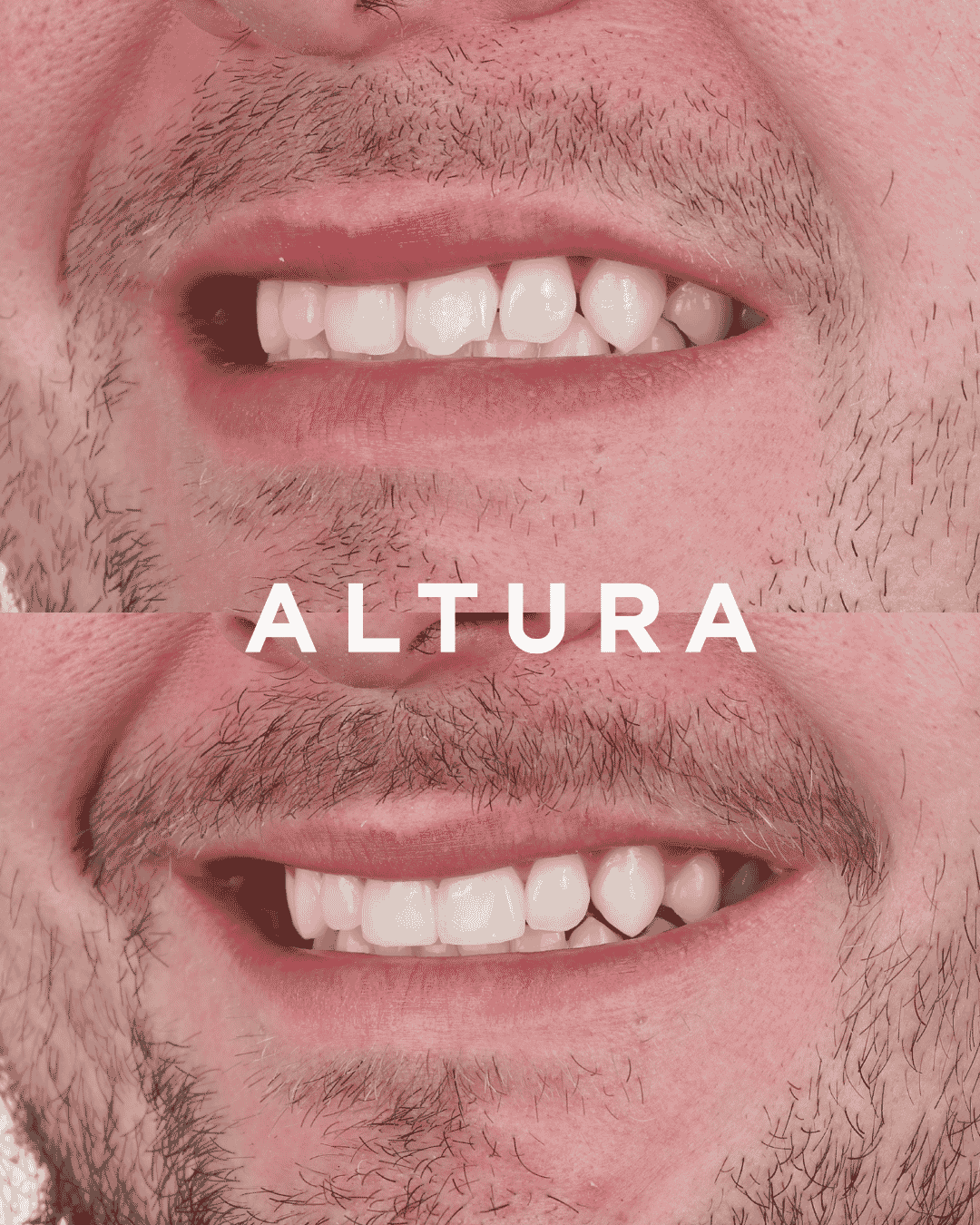 C-EB-AC-TEETH-AM2