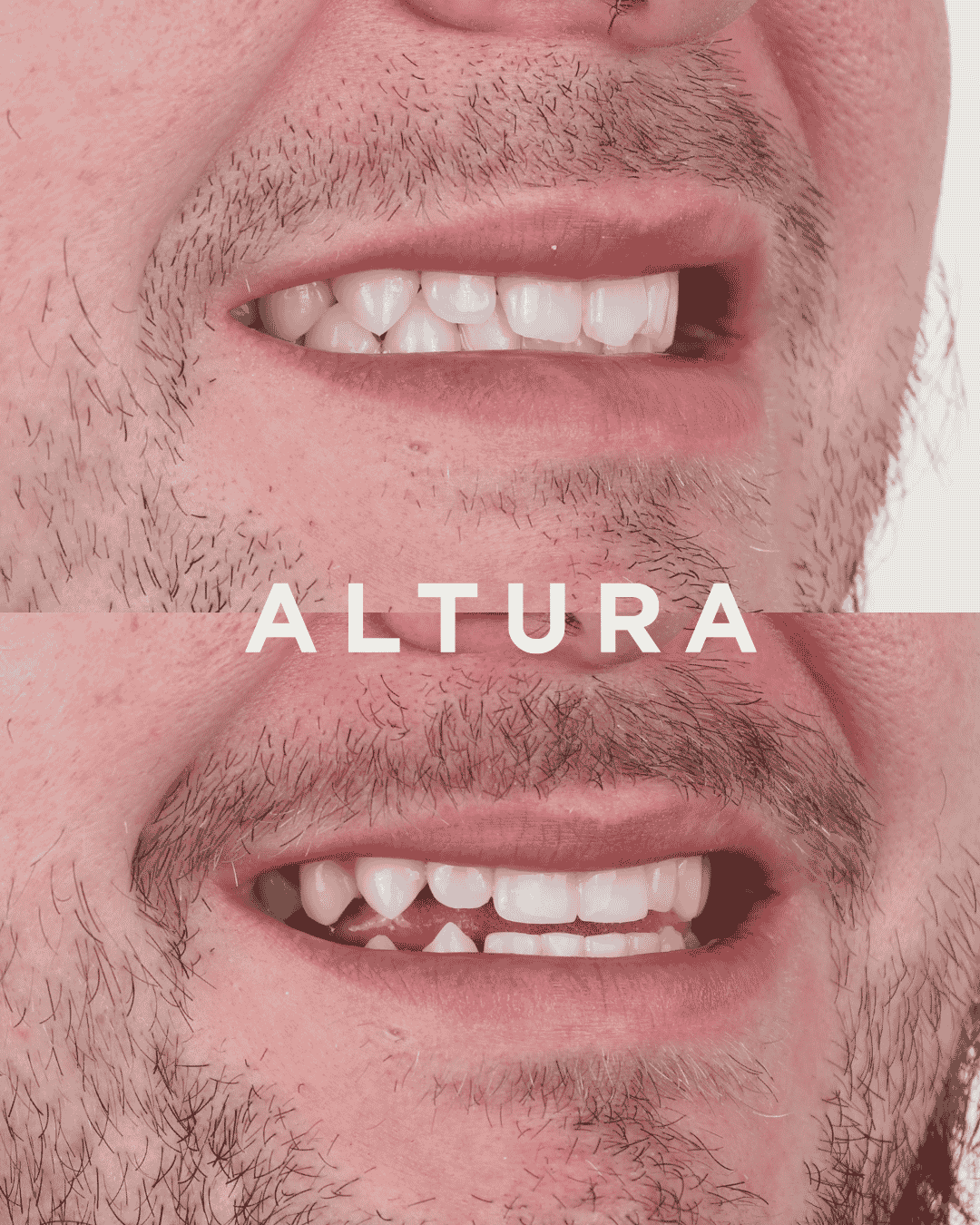 C-EB-AC-TEETH-AM3
