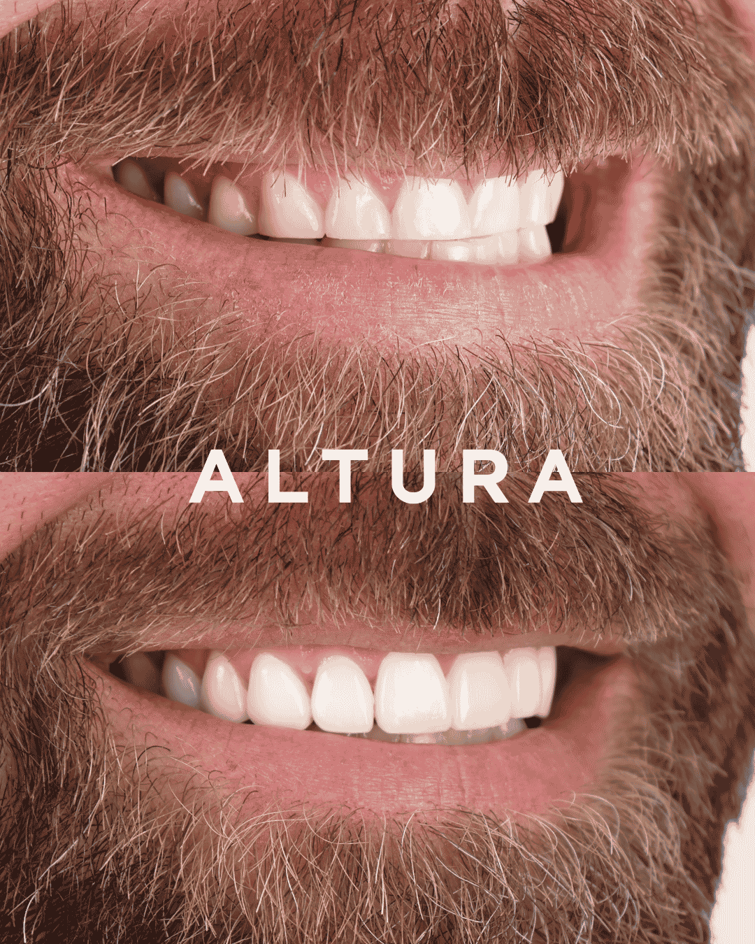 C-PV-AC-TEETH-DR3