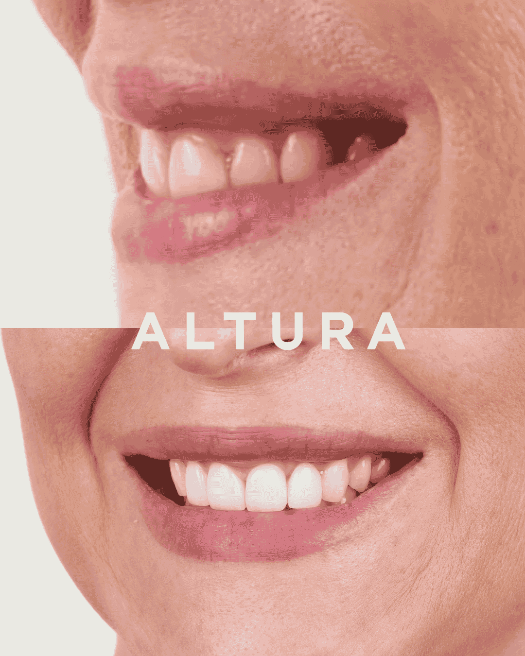 C-PV-AC-TEETH-KM2