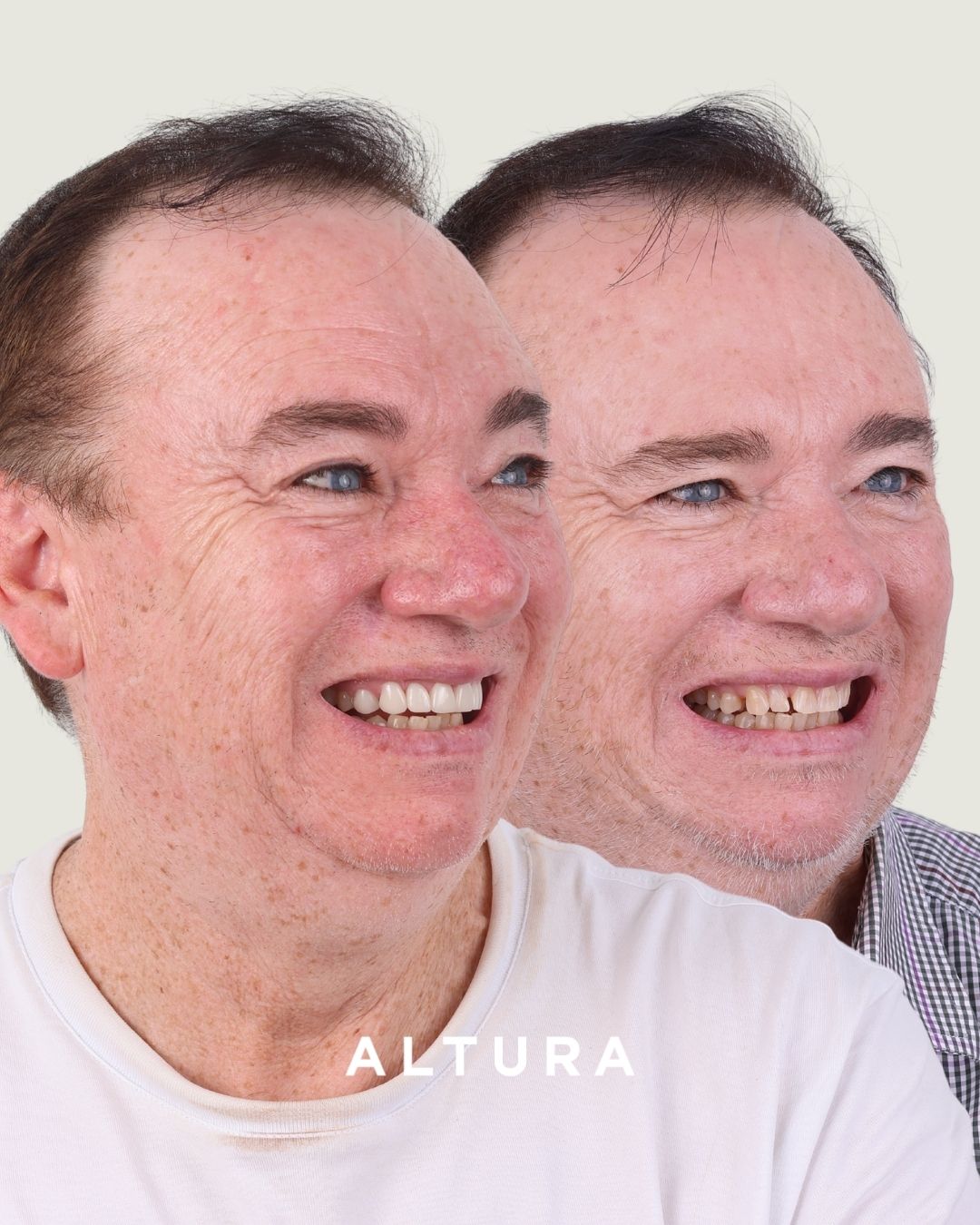 C-CR-AC-FACE-SH-4