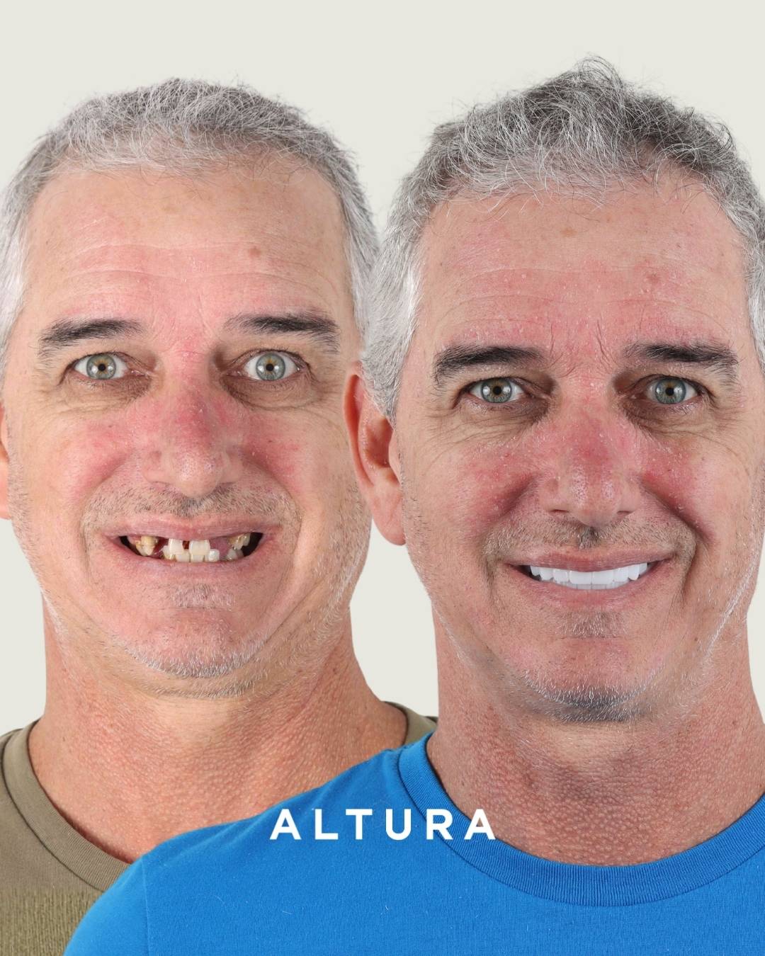 I-X-AC-FACE-TC-1