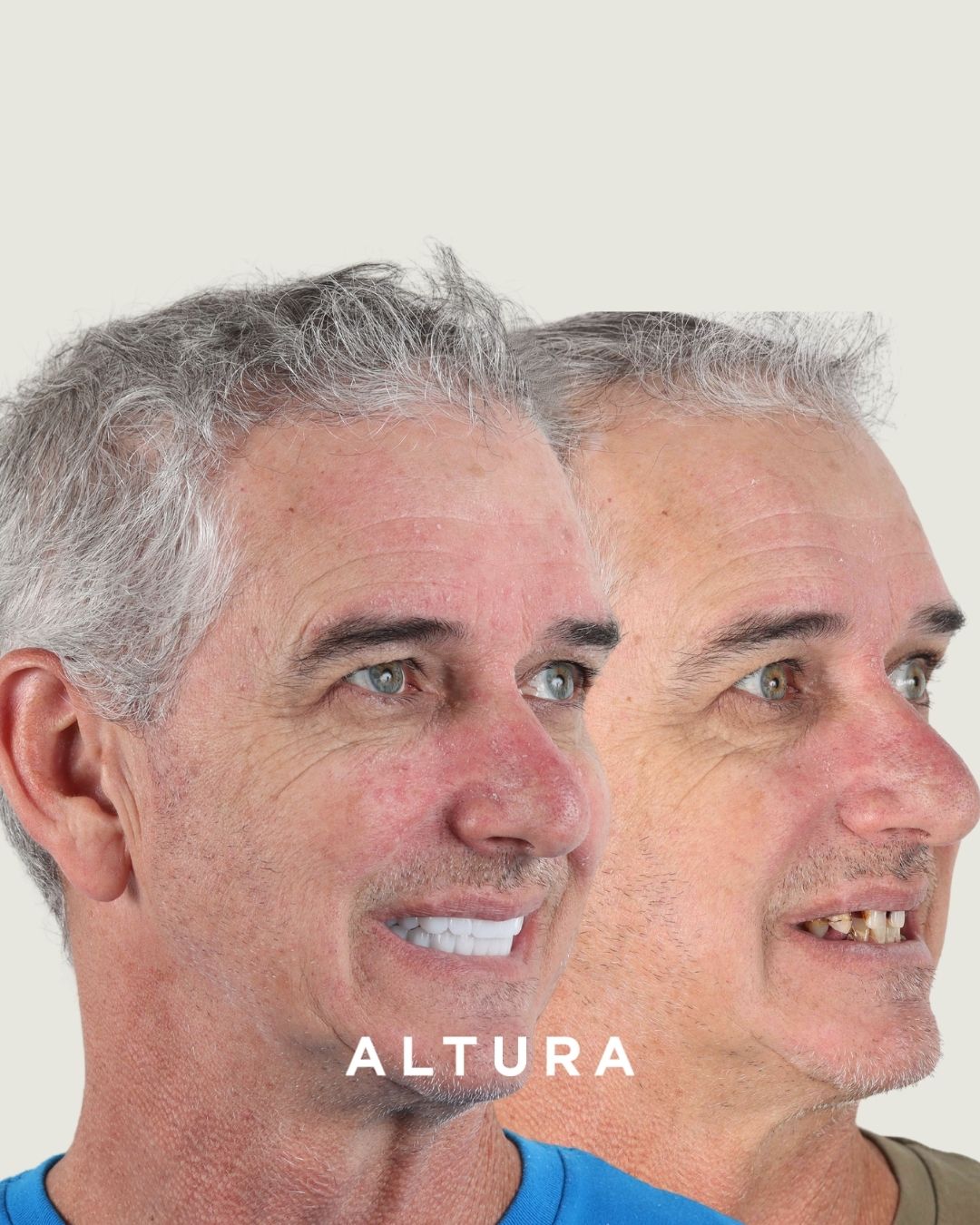 I-X-AC-FACE-TC-2