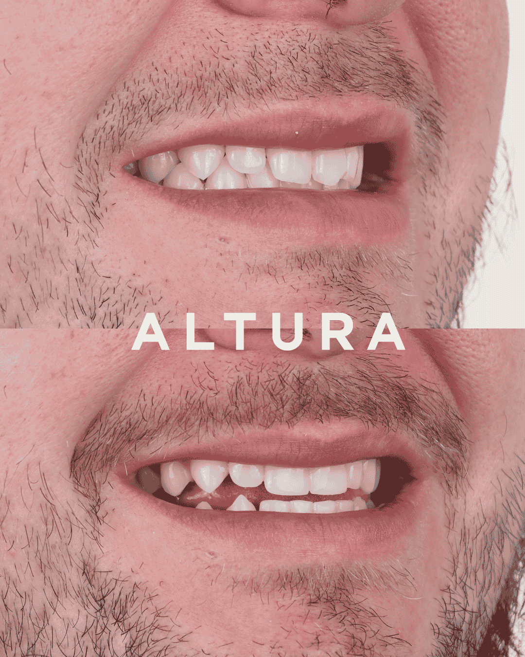 C-EB-AC-TEETH-AM-3